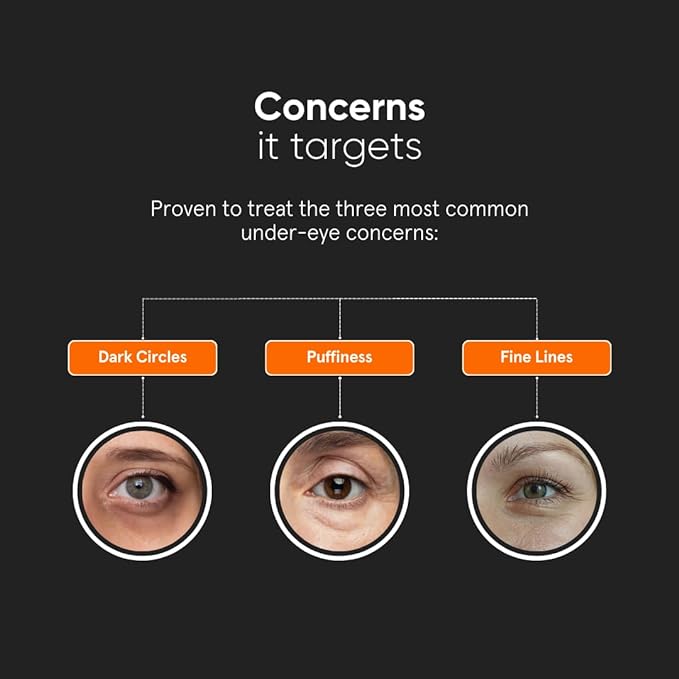 Minimalist Vitamin K + Retinal 01% Under Eye Cream | Reduces Dark Circles, Wrinkles & Fine Lines | With Caffeine for Puffiness | For Women & Men | 14 gm