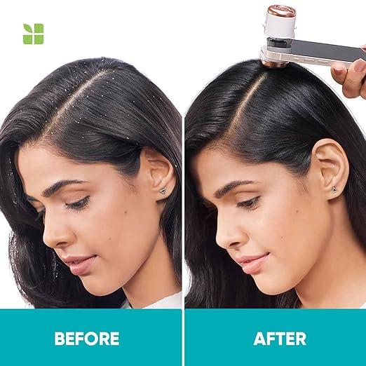 Matrix Biolage Advanced Scalppure Anti-Dandruff Shampoo (200ml)