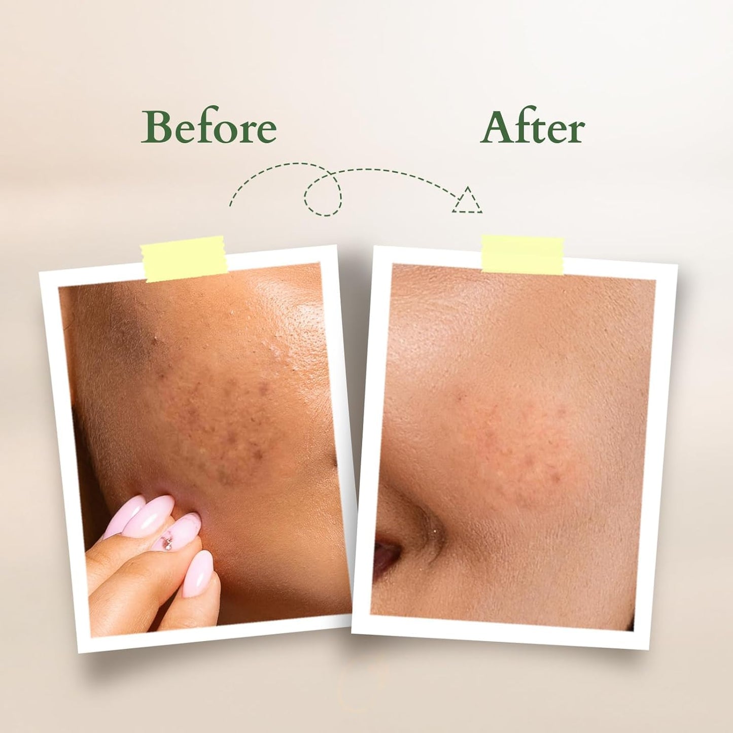 Lotus Organics+ Vitamin C Radiance Booster Face Serum| 100% Certified Organic Lemon Verbena | Brightens & Evens Skin Tone | For Dull & Dehydrated Skin 30ml