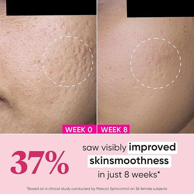 Dot & Key Night Reset Retinol + Ceramide Night Cream | Anti Aging Cream For Women & Men | Reduces Fine Lines & Wrinkles | Oil Free & Non Sticky Moisturizer