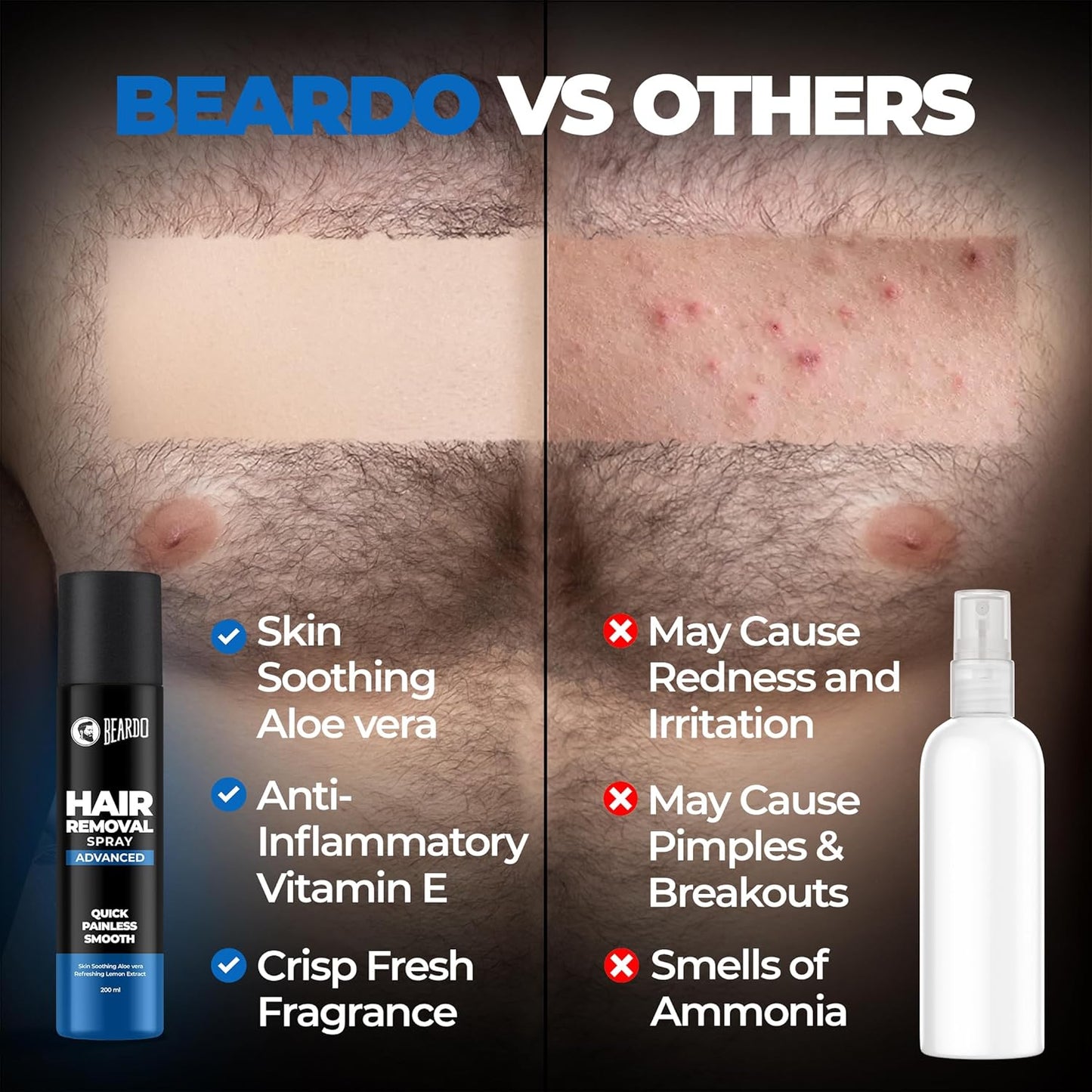 Beardo Hair Removal Spray for Men – Painless |Aloe Vera & Lemon | Gentle on Skin | No Burning or Itching | Brightening De-Tan Formula