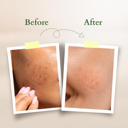 Lotus Organics+ Vitamin C Radiance Booster Face Serum| 100% Certified Organic Lemon Verbena | Brightens & Evens Skin Tone | For Dull & Dehydrated Skin 30ml