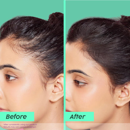 Plix Rosemary Advanced Anti HairFall Shampoo for Decreases Hair Fall & Breakage - 200 ml | All Hair Types | Men & Women | Sulphate & Paraben Free